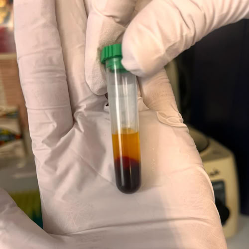 Veterinaria analizando muestra de sangre en el laboratorio de la clínica veterinaria El Jardín.